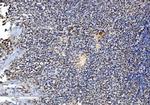 DDX1 Antibody in Immunohistochemistry (Paraffin) (IHC (P))