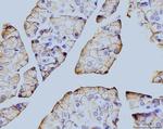 Annexin A6 Antibody in Immunohistochemistry (Paraffin) (IHC (P))