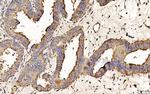 PDIA6 Antibody in Immunohistochemistry (Paraffin) (IHC (P))