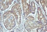 UBA2 Antibody in Immunohistochemistry (Paraffin) (IHC (P))