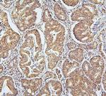 UBA2 Antibody in Immunohistochemistry (Paraffin) (IHC (P))