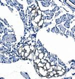 eRF1 Antibody in Immunohistochemistry (Paraffin) (IHC (P))