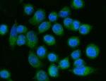 ACSL4 Antibody in Immunocytochemistry (ICC/IF)