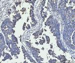 ACSL4 Antibody in Immunohistochemistry (Paraffin) (IHC (P))