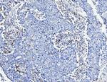 ACSL4 Antibody in Immunohistochemistry (Paraffin) (IHC (P))