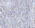 ACSL4 Antibody in Immunohistochemistry (Paraffin) (IHC (P))