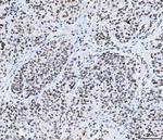 CPSF6 Antibody in Immunohistochemistry (Paraffin) (IHC (P))