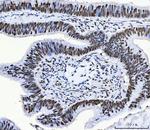 CPSF6 Antibody in Immunohistochemistry (Paraffin) (IHC (P))