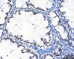 CPSF6 Antibody in Immunohistochemistry (Paraffin) (IHC (P))