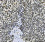 CPSF6 Antibody in Immunohistochemistry (Paraffin) (IHC (P))