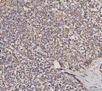 MDH2 Antibody in Immunohistochemistry (Paraffin) (IHC (P))