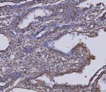 MDH2 Antibody in Immunohistochemistry (Paraffin) (IHC (P))