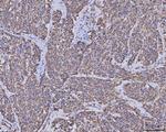 MDH2 Antibody in Immunohistochemistry (Paraffin) (IHC (P))