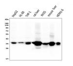 AKR1D1 Antibody in Western Blot (WB)