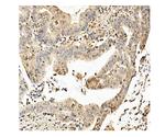 CKAP5 Antibody in Immunohistochemistry (Paraffin) (IHC (P))