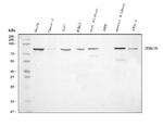 SEMA3B Antibody in Western Blot (WB)