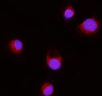 ERLIN2 Antibody in Immunocytochemistry (ICC/IF)