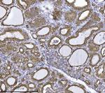 ERLIN2 Antibody in Immunohistochemistry (Paraffin) (IHC (P))