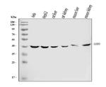 Sorbitol Dehydrogenase Antibody in Western Blot (WB)