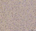 Calcineurin B Antibody in Immunohistochemistry (Paraffin) (IHC (P))