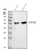 Calcineurin B Antibody in Western Blot (WB)