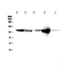 alpha Actinin 2 Antibody in Western Blot (WB)