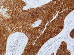 EGFR Antibody in Immunohistochemistry (Paraffin) (IHC (P))