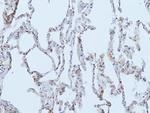 EGFR Antibody in Immunohistochemistry (Paraffin) (IHC (P))