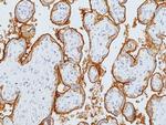 EGFR Antibody in Immunohistochemistry (Paraffin) (IHC (P))