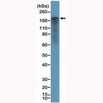 EGFR Antibody in Western Blot (WB)