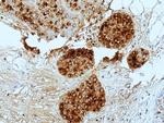 GCDFP-15 Antibody in Immunohistochemistry (Paraffin) (IHC (P))