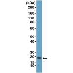 GCDFP-15 Antibody in Western Blot (WB)