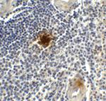 TIGIT Antibody in Immunohistochemistry (Paraffin) (IHC (P))