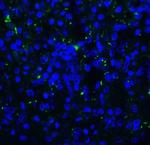 TIGIT Antibody in Immunohistochemistry (Paraffin) (IHC (P))