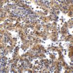 TIGIT Antibody in Immunohistochemistry (Paraffin) (IHC (P))