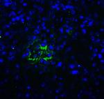 TIGIT Antibody in Immunohistochemistry (Paraffin) (IHC (P))