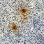 TIGIT Antibody in Immunohistochemistry (Paraffin) (IHC (P))