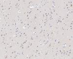 CRBN Antibody in Immunohistochemistry (Paraffin) (IHC (P))