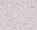 SIAH1 Antibody in Immunohistochemistry (Paraffin) (IHC (P))