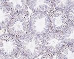 SIAH1 Antibody in Immunohistochemistry (Paraffin) (IHC (P))