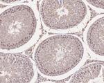 SIAH1 Antibody in Immunohistochemistry (Paraffin) (IHC (P))