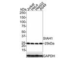 SIAH1 Antibody in Western Blot (WB)