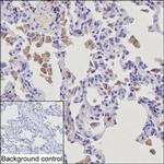 GM-CSF Antibody in Immunohistochemistry (Paraffin) (IHC (P))