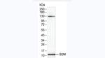 beta-2 Microglobulin Antibody in Western Blot (WB)