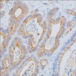 MCP-1 Antibody in Immunohistochemistry (Paraffin) (IHC (P))