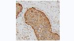 TUBA4A Antibody in Immunohistochemistry (Paraffin) (IHC (P))