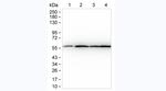 TUBA4A Antibody in Western Blot (WB)