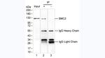 Acetyl-SMC2 (Lys114) Antibody in Immunoprecipitation (IP)