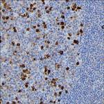 J Chain Antibody in Immunohistochemistry (Paraffin) (IHC (P))