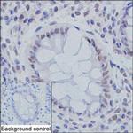 SMC3 Antibody in Immunohistochemistry (Paraffin) (IHC (P))